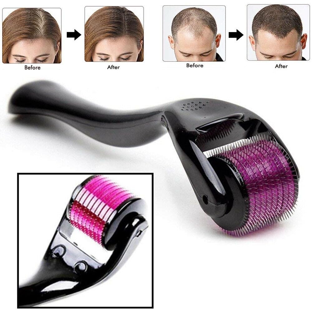 Derma Roller For Hair Growth 0.5 mm with 540 Stainless Steel Needles